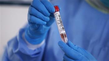 الإمارات تسجل 377 إصابة جديدة بفيروس كورونا