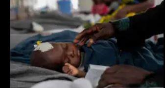 زيمبابوي: وفاة أكثر نحو 700 طفل بعد تفشي مرض الحصبة