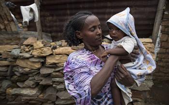 "يونيسيف": سوء التغذية الحاد يهدد 1.5 مليون طفل في الصومال ووفاة 730 آخرين