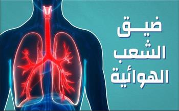يحد من التنفس الطبيعي .. ما مرض ضيق الشعب الهوائية؟