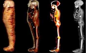 الأشعة المقطعية تكشف أسرار مومياء الصبي الذهبي ببدروم المتحف المصري بالتحرير