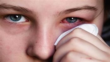 العين الوردية .. مرض تسببه العدسات اللاصقة