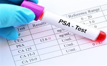 للرجال بعد الخمسين.. تحليل "PSA" واجب علاجى ووقائي