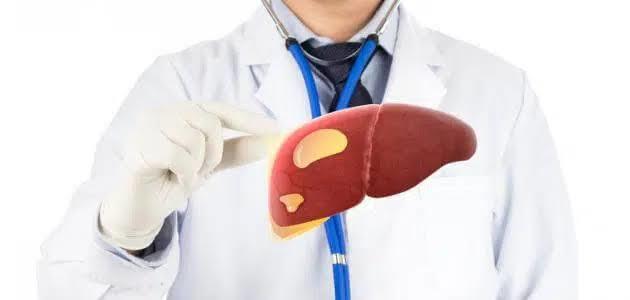 أعراض تنبهك بالإصابة بالكبد الدهني
