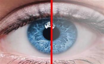 مضاعفاتها خطيرة لا تهملوا علاج المياه الزرقاء