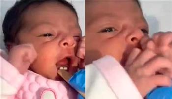 حالة نادرة.. ولادة طفلة بأسنان أمامية تثير دهشة رواد مواقع التواصل (فيديو)