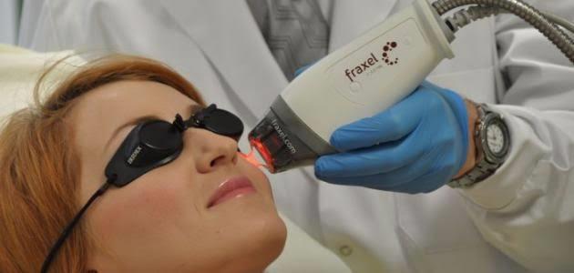 الجراحة التجميلية لعلاج حب الشباب لها شروط تعرف عليها