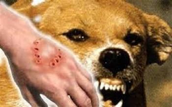 كلب مسعور يهاجم طفلة بقنا 