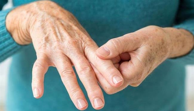 احترس .. هذه الأعراض مؤشر لإصابتك بالروماتويد