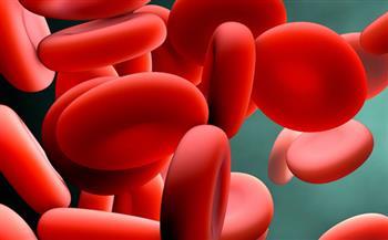 أعراض فقر الدم الناتج عن نقص الحديد 