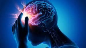 5 مؤشرات للإصابة بالسكتة الدماغية