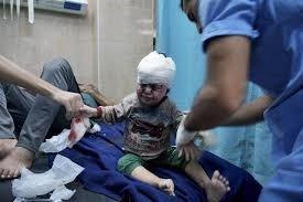 ممرضة أمريكية خرجت من غزة: الأطفال مصابون بحروق وجروح وبتر جزئي