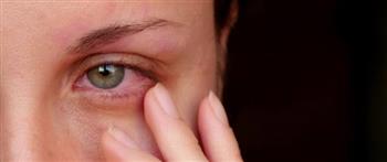نصائح لمعالجة التهاب العيون