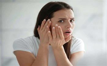 دراسة توضح أسباب تأثير التوتر على ملامح الوجه والبشرة