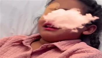 طفلة تتعرض لإصابة خطيرة في عينها بسبب هجوم قطّة منزلية (فيديو)