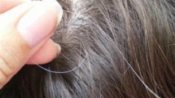 7 أضرار لنتف الشعر الأبيض .. منها التهاب فروه الرأس