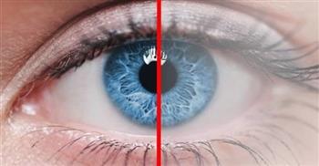 اسباب إعتام عدسة العين