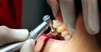طبيب أسنان يجري 32 عملية لمريضة في يوم واحد 