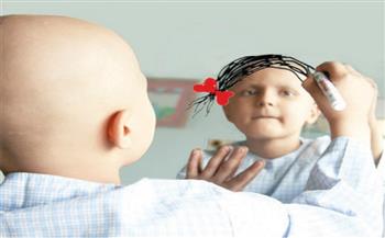 في يومه العالمي.. «الصحة» توضح أسباب الإصابة بسرطان الأطفال