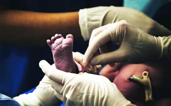 ولادة طفلة بذيل في البرازيل.. هكذا تعامل معها الأطباء