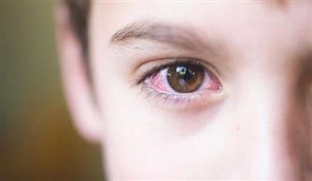 حافظي على عيون طفلك من التهاب الرمد الربيعي
