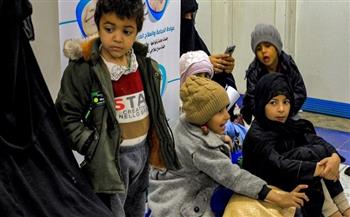 يونيسف: 11 مليون طفل في اليمن معرضون لسوء التغذية
