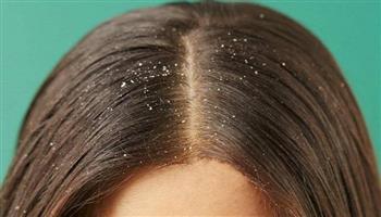 ليس هناك علاج حاسم لمشكلة قشرة الشعر