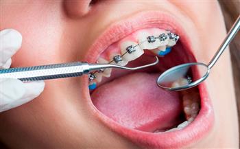 شبكة «رائد» تنظم ورشة عمل إقليمية حول مخاطر استخدام الزئبق في علاج الأسنان الإثنين المقبل