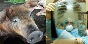 تايوان تسجل الحالة الثالثة من أنفلونزا الخنازير