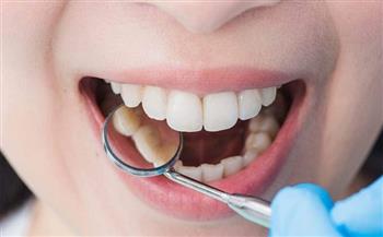 الصحة : تقديم الخدمات المتخصصة في طب الأسنان لـ 3 ملايين مواطن  