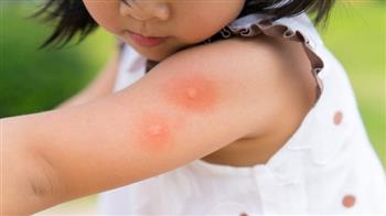 للأمهات .. وصفات طبيعية لحماية أطفالك من لدغ الحشرات