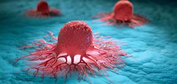 دراسة تحذر: الخلايا السرطانية تنمو عند نقص السكر