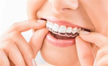 تعرف على فوائد تقويم الاسنان