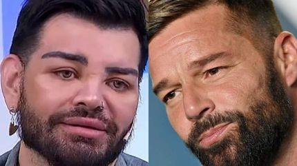معجب مهووس بريكي مارتن يخضع لأربعين عملية تجميل ليبدو مثله