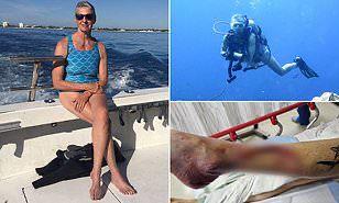 غطاسة تفقد ساقها في هجوم سمكة قرش بجزر الباهاما