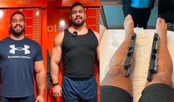 عقدة حياته.. رجل ينفق 100 ألف دولار ليصبح أطول من زوجته