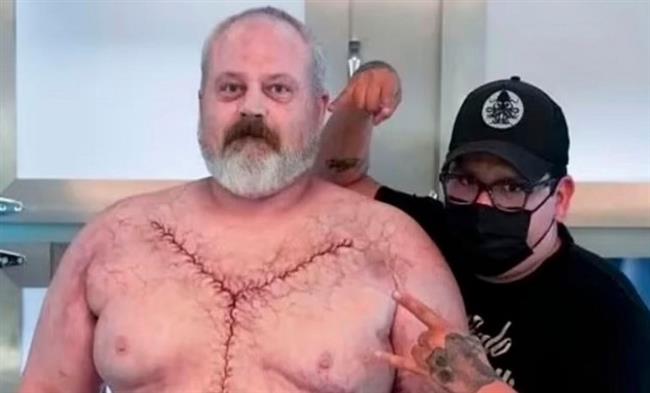أمريكي يتظاهر بالموت طيلة 321 يومًا من أجل دور جثة في مسلسل شهير