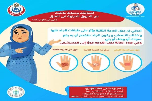 «الصحة» تكشف طرق التعرف على حروق الجلد بدرجاته المختلفة 
