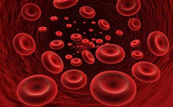 دراسة جديدة تكشف 37 سببا لفقر الدم