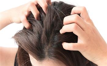 8 طرق للتخلص من حكة الشعر في فصل الصيف