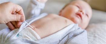 أسباب التهاب سرة البطن عند الرضع