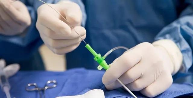 أهم الأعراض التي تتطلب استشارة الطبيب بعد تركيب الدعامة