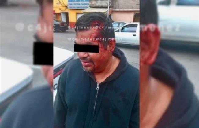 جمجمة مضادة للرصاص.. مكسيكي ينجو من الموت بعد إطلاق النار عليه مرتين