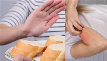 أعراض حساسية القمح