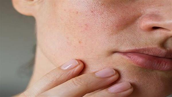 عيوب وأضرار  استخدام مستحضرات التجميل مجهولة المصدر
