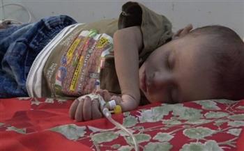 الصحة العالمية تعرب عن قلقها بسبب ارتفاع عدد الإصابات والوفيات بالحصبة بين الأطفال في اليمن