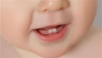 تعرف على اسباب تاخر نمو الأسنان عند الرضع