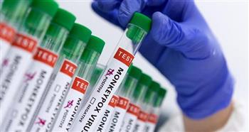 دراسة: التطعيم ضد جدري القرود يخفف من شدة المرض