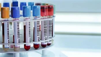 باحثون أمريكيون يطورون اختبار دم لتشخيص شلل الرعاش مبكرا 