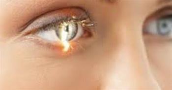 هل يؤثر الروماتيزم على العين؟